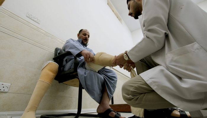 301122-undp-iraq-Anbar - Fallujah prosthetics center The employee installs the prosthesis for Saleh and replaces it with the old prosthesis that he had previously tired and felt comfortable with the new prosthesis